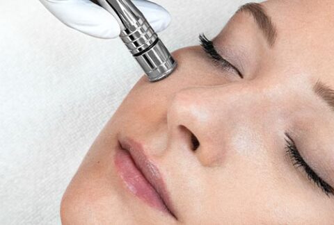 Diamant Microdermabrasion