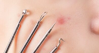 Derma Control Classic – Ideal für die unreine Haut!!