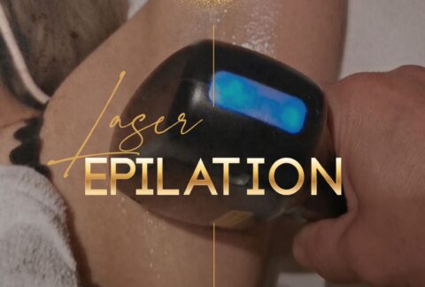 LASEREPILATION